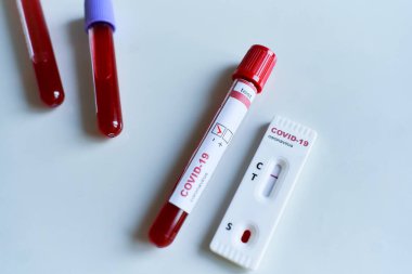 COVID-19 virüsü için hızlı test cihazı ve viral roman koronavirüsü için kan örneği içeren tüp kullanarak negatif test sonucu. Test sonuçları, hastalık salgınlarının engellenmesi..