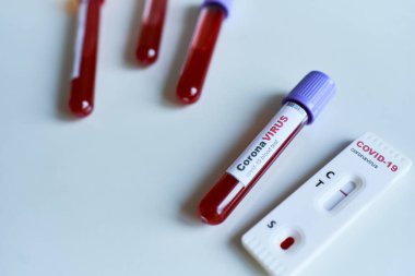 COVID-19 için kan örneği ve Coronavirus enfeksiyonu için hızlı test tüpü. Teşhis, araştırma test sonuçları, hastalık salgınlarının engellenmesi