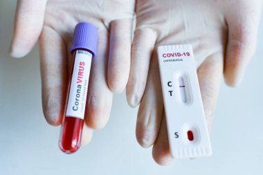Doktor elinde COVID-19 virüsü için negatif ekspres test cihazı ve viral Coronavirus için kan örneği olan test tüpü tutan eldivenler tutuyor. Test sonuçları, hastalık salgınlarının engellenmesi..
