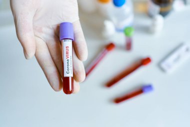 Yakın plan doktor ellerinde COVID-19 analizi için kan örneğiyle test tüpü tutan eldivenler tutuyor. Coronavirüs veya covid-19 test sonuçları
