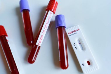 COVID-19 için kan örneği ve Coronavirus enfeksiyonu için negatif hızlı test tüpü..