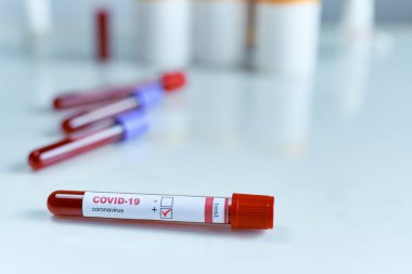Kan örneği içeren test tüpü, koronavirüsün varlığı için kan tahlili sonuçları pozitif.