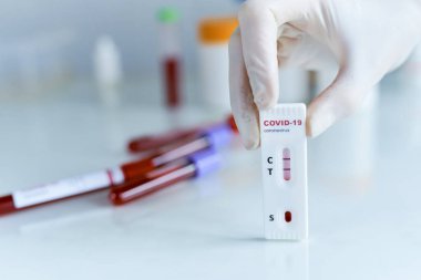 Eldivenlerdeki sıhhiyeciler COVID-19 testini gösteriyor. Arka planda kan örneği içeren test tüpleri.