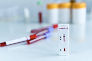 COVID-19 testleri negatif sonuç verdi. Virüs salgını için laboratuvar kartı testi yapıldı..