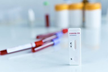 COVID-19 testleri, virüs salgını için laboratuvar kartı testleri..