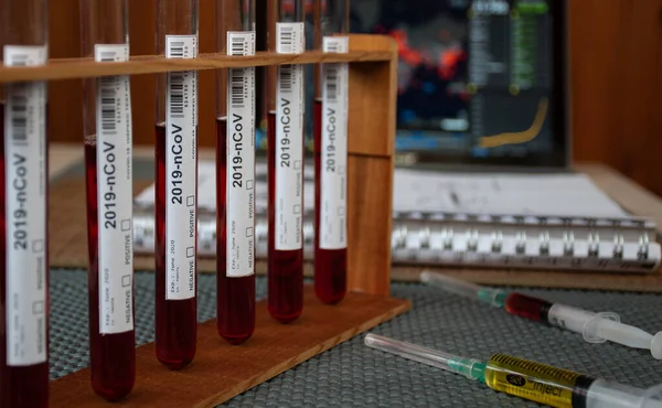 Masada Coronavirus için kan testi örnekleri var.