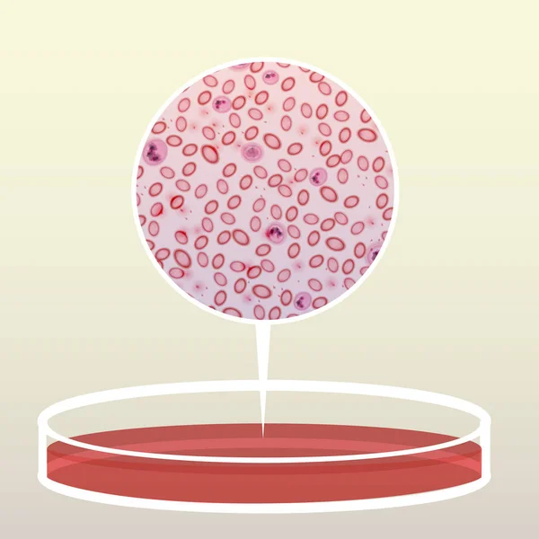 Petri Dish with Blood, Magnified Area  - Vector Illustration — Stock Vector