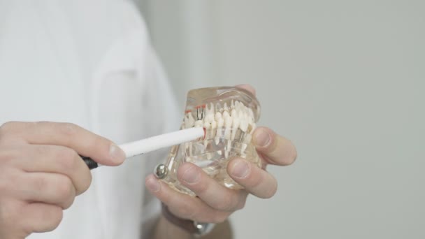 Dentista sosteniendo modelo de mandíbula con dientes implantados. Explicación para el estudiante — Vídeos de Stock