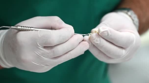 Trabajo Dental Laboratorio Dental — Vídeo de stock