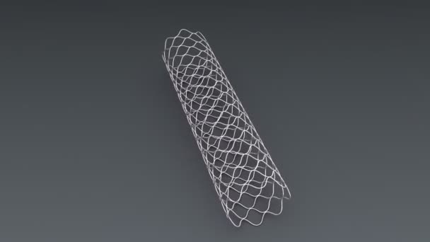 Endovascular plastic stent — Stock Video