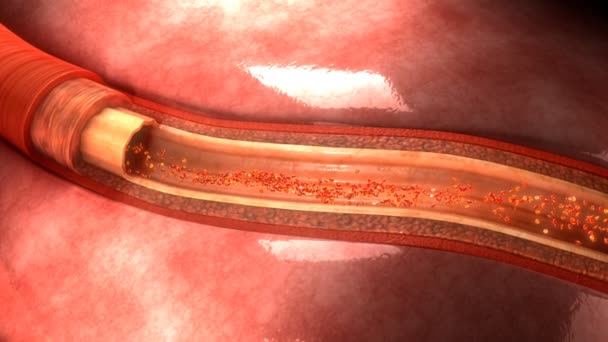 Anatomía de la arteria humana — Vídeo de stock