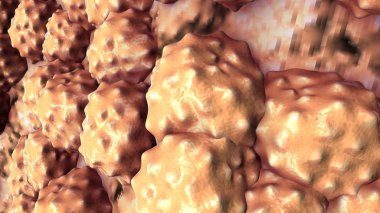 Romatoid artrit yakın çekim