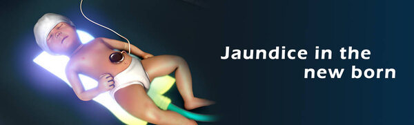 новорожденный ребенок с желтухой
 
