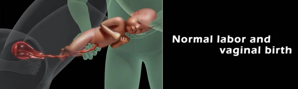 Normale arbeid en vaginale geboorte — Stockfoto