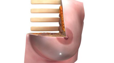 Göğüs illüstrasyon kesişimi