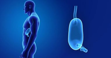 Mide zoom ile iskelet posterior