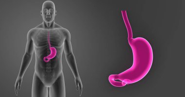 Mide zoom ile iskelet 