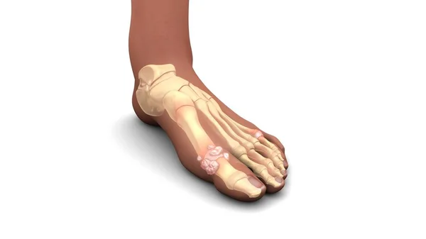 Human foot bones — Stock Photo, Image