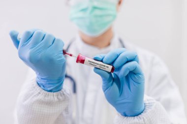 Coronavirus (COVID-19) için hastaların kan örneklerini test eden doktor, içinde koronavirüs pozitif veya negatif bir kan örneği bulunmayan bir test tüpü tutar..