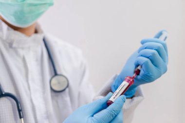 Coronavirus (COVID-19) için hastaların kan örneklerini test eden doktor, içinde koronavirüs pozitif veya negatif bir kan örneği bulunmayan bir test tüpü tutar..