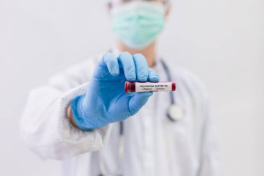 Coronavirus (COVID-19) için hastaların kan örneklerini test eden doktor, içinde koronavirüs pozitif veya negatif bir kan örneği bulunmayan bir test tüpü tutar..