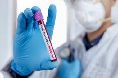 Coronavirus (COVID-19) için hastaların kan örneklerini test eden doktor, içinde koronavirüs pozitif veya negatif bir kan örneği bulunmayan bir test tüpü tutar..