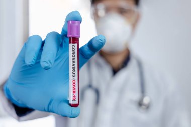 Coronavirus (COVID-19) için hastaların kan örneklerini test eden doktor, içinde koronavirüs pozitif veya negatif bir kan örneği bulunmayan bir test tüpü tutar..