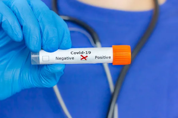 Coronavirus Smear Tube Her Hand — Stock Photo, Image