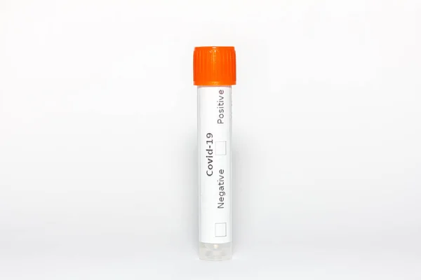 Swab tubes for testing for the corona virus