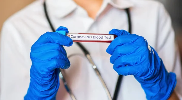 2019 Nkov Coronavirus Blutprobe Den Händen Des Arztes Ausbruch Des — Stockfoto