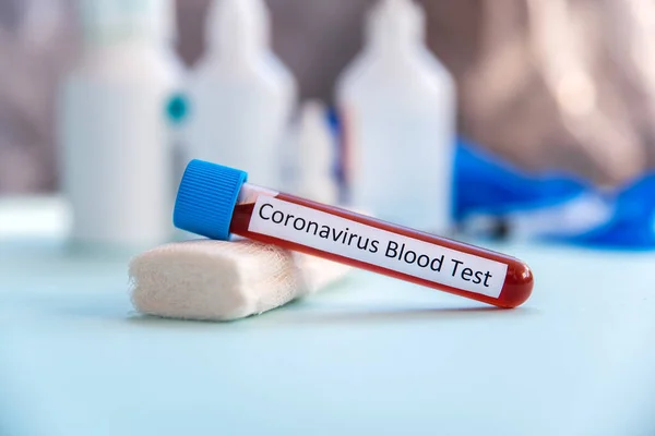 Coronavirus Bluttest Konzept Laborröhrchen Mit Dem Blut Von Patienten Ausbruch — Stockfoto