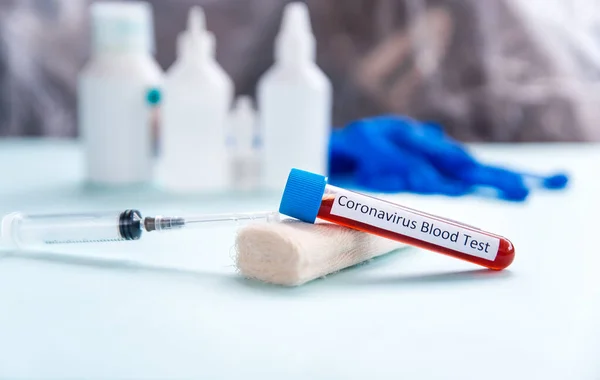 Coronavirus Bluttest Konzept Laborröhrchen Mit Dem Blut Von Patienten Mit — Stockfoto