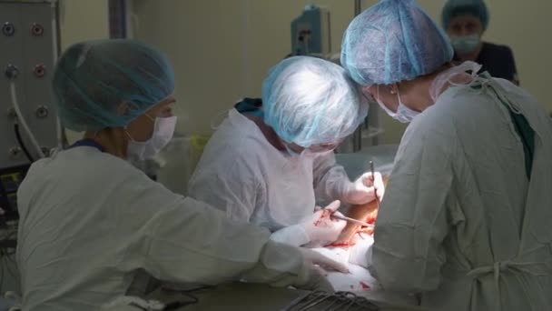 Médicos realizam cirurgia médica — Vídeo de Stock