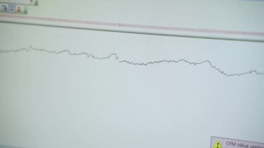 Monitörde elektrokardiyogram görüntüsü, kalp atışlarının hareket eden grafiği, tıbbi ekipmanlar.