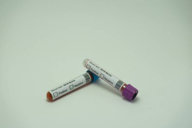 Ön planda koronavirüsün iki kan testi var. Bir tüp kan 2019-NcOv için pozitif, diğeri ise negatif..