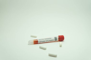 Koronavirüsün haplarla çevrili kan testi. Kan tüpü 2019-NcOv için pozitif çıktı..