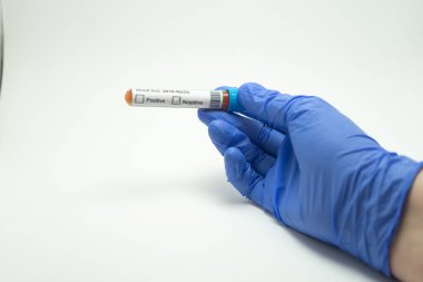 El ele tutuşup kan testi yapacağız. Kan testi Coronavirus, 2019-NcOv 'dan. Koronavirüs testi negatif çıktı. Eldiven mavi, arka plan beyaz..
