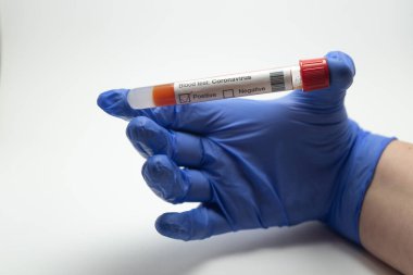 El ele tutuşup kan testi yapacağız. Kan testi Coronavirus, 2019-NcOv 'dan. Testlerde koronavirüs pozitif çıktı. Eldiven mavi, arka plan beyaz..
