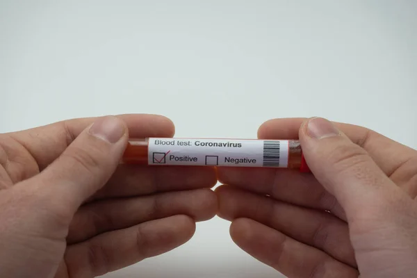 Voorgrond Een Bloedtest Van Het Coronavirus Met Twee Handen Bloedbuis — Stockfoto