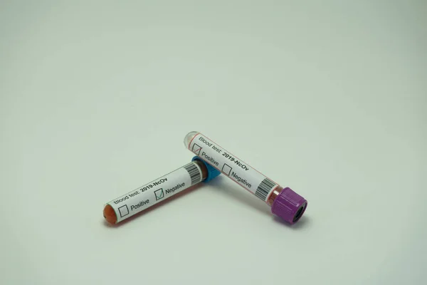 Foreground Two Blood Tests Coronavirus One Tube Blood Positive 2019 — Stock Photo, Image