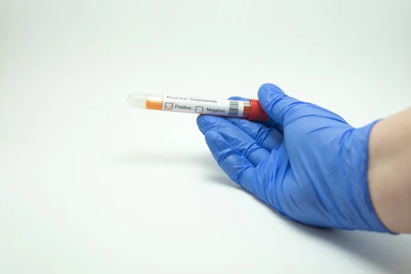 Hand Met Een Bloedtest Bloedtest Van Coronavirus 2019 Ncov Tests — Stockfoto