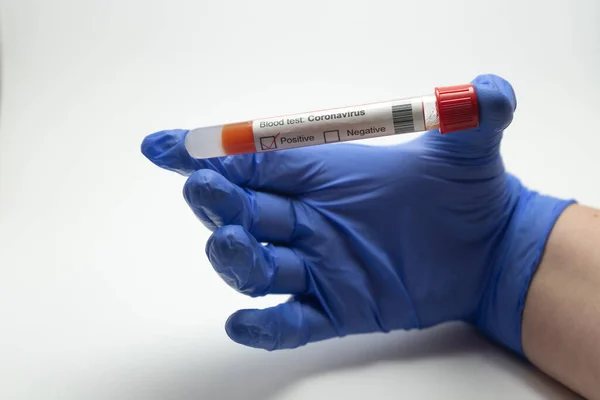 El ele tutuşup kan testi yapacağız. Kan testi Coronavirus, 2019-NcOv 'dan. Testlerde koronavirüs pozitif çıktı. Eldiven mavi, arka plan beyaz..