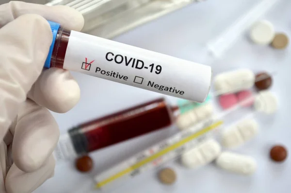 Plastik eldiven giymiş bir tıp çalışanının elinde COVID-19 için pozitif bir test sonucu bulunan bir test tüpünde ilaç, kan şırıngası ve termometre bulunan bir kan örneği bulunur.
