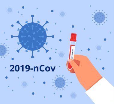Bir doktor, yeni 2019 nCov Coronavirus için üzerinde kan olan bir test tüpü tutuyor. ChOVID-2019 'a karşı mücadele kavramı