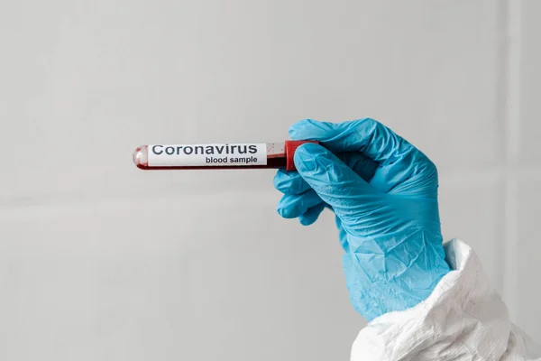 Bijgesneden Weergave Van Persoon Latex Handschoen Met Coronavirus Bloedmonster — Gratis stockfoto