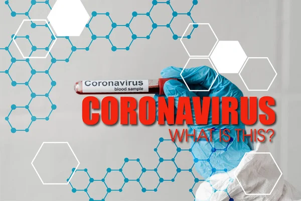 Bijgesneden Weergave Van Persoon Latex Handschoen Met Coronavirus Bloedmonster — Stockfoto