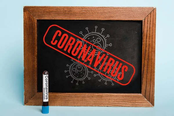 Lettering coronavírus escrito em chalkboard perto do tubo de ensaio com amostra de sangue no fundo azul — Fotografia de Stock