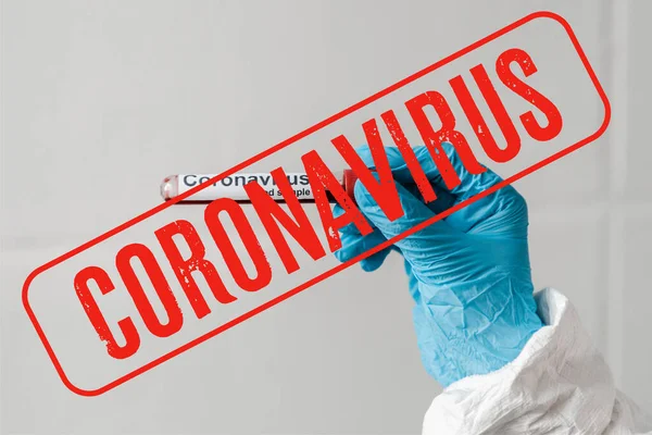 Cropped view of person in latex glove holding blood sample, coronavirus illustration — Stock Photo