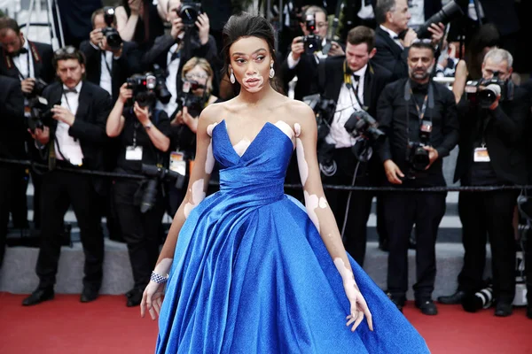 Modeli Winnie Harlow