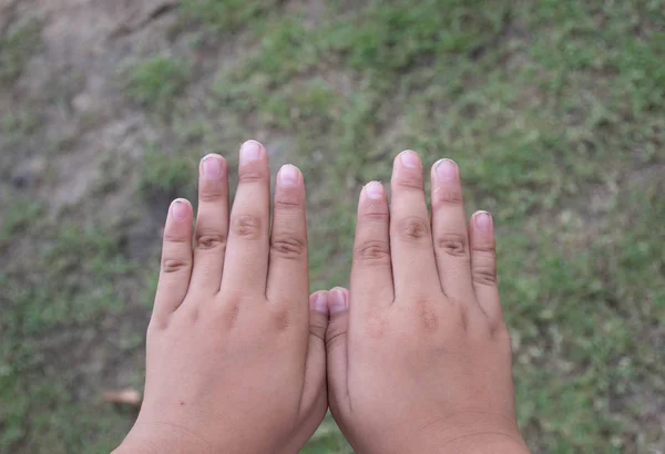 The long and dirty nails of a schoolboy. — Stock Photo, Image